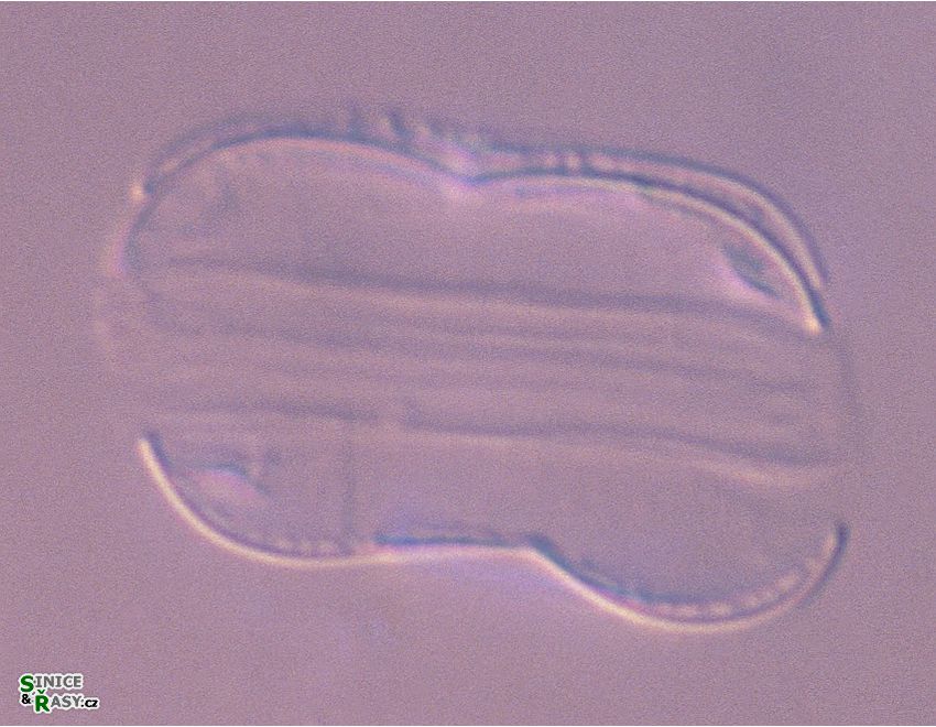 Entomoneis