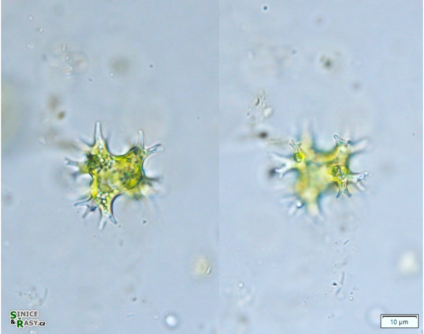 Pseudostaurastrum enorme