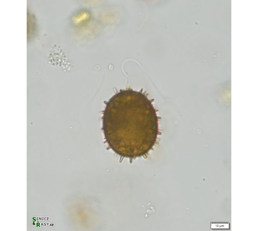 Trachelomonas superba