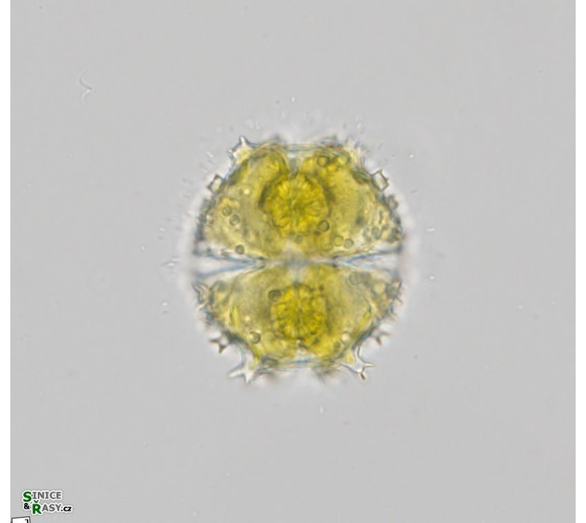 Staurastrum spongiosum