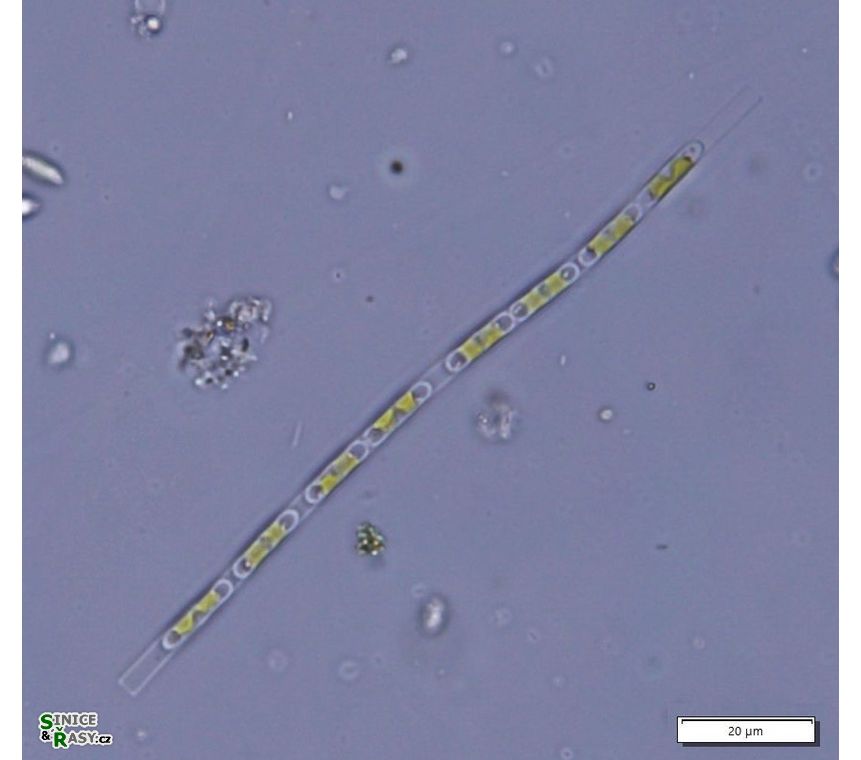 Binuclearia lauterbornii