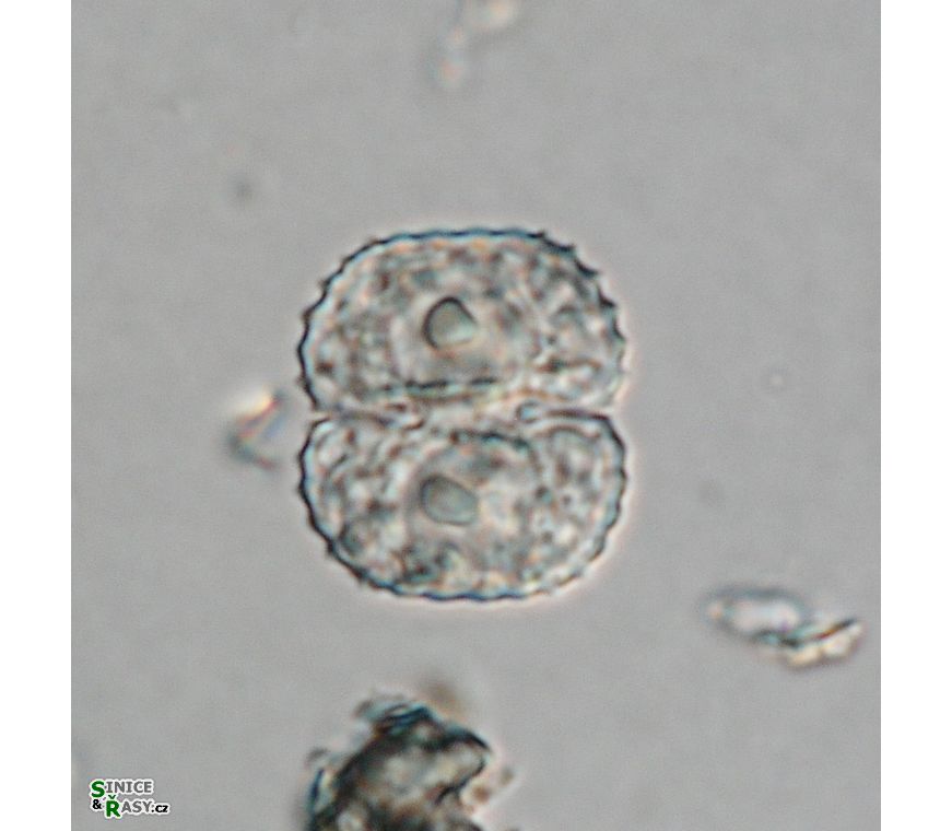 Cosmarium vogesiacum