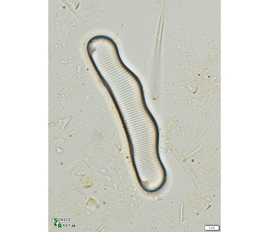 Eunotia monodon