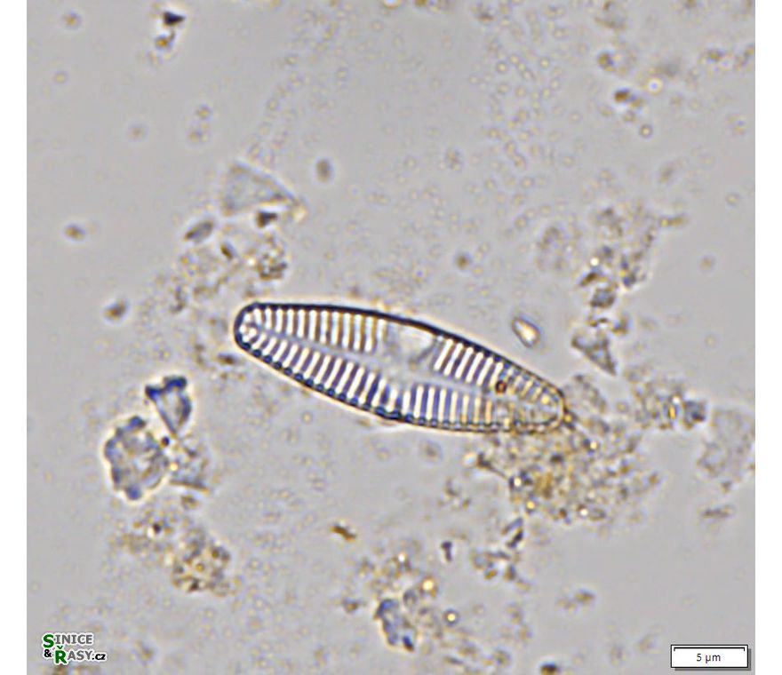 Planothidium lanceolatum