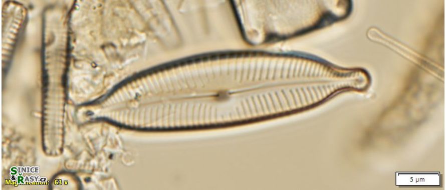 Cymbopleura naviculiformis