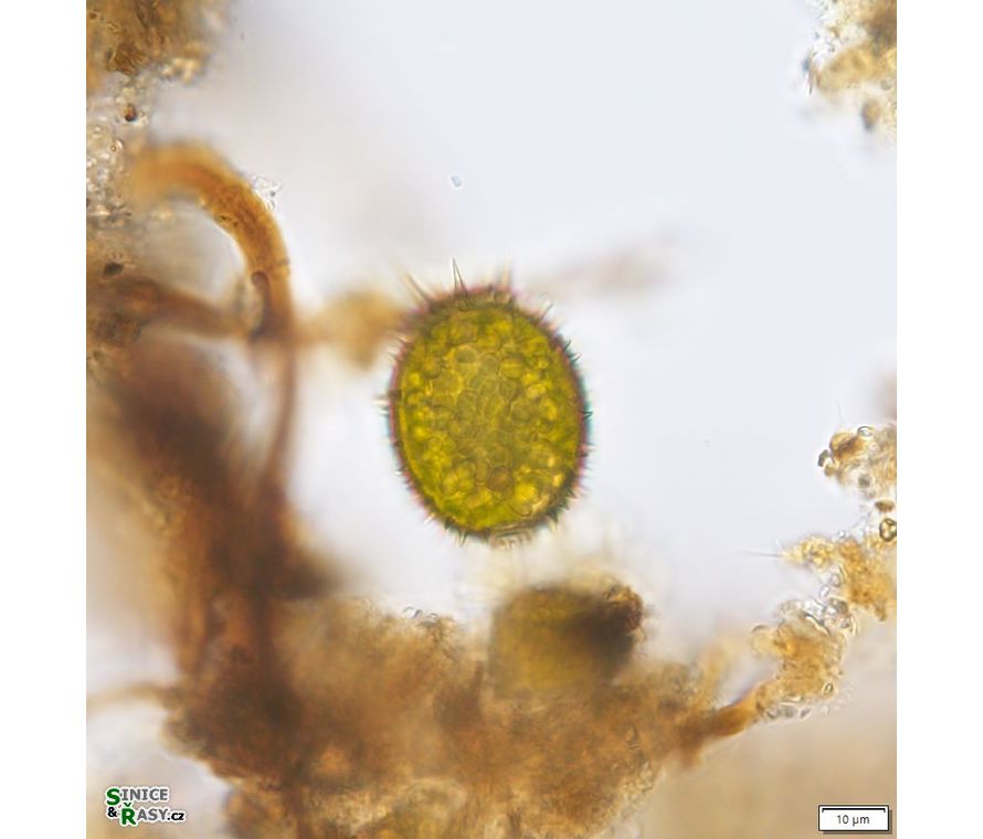 Trachelomonas superba