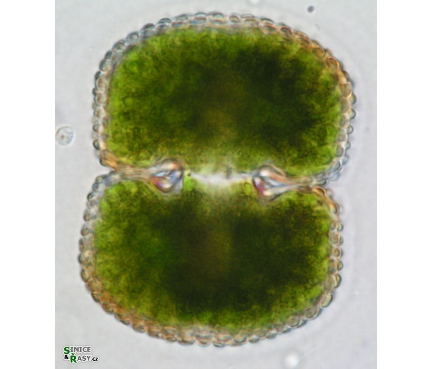 Cosmarium conspersum