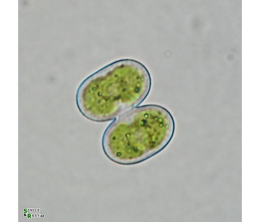 Cosmarium contractum