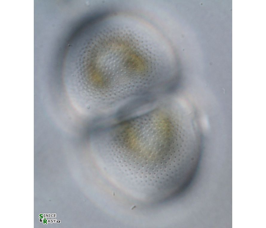 Cosmarium incrassatum