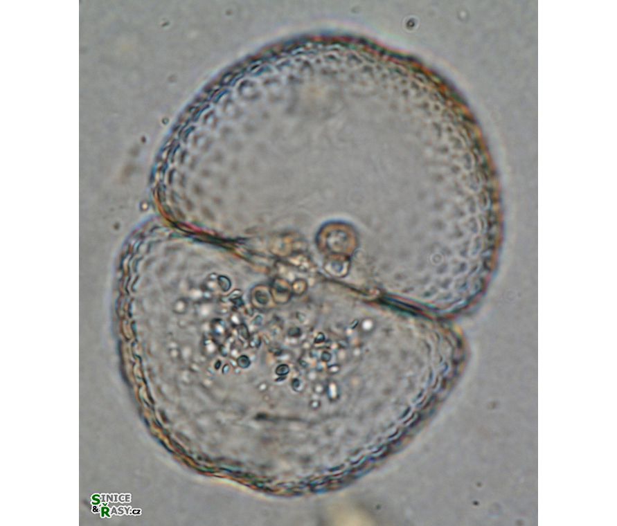 Cosmarium ochthodes