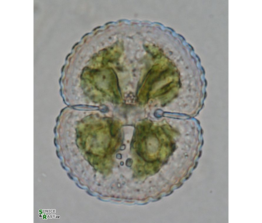Cosmarium subspeciosum