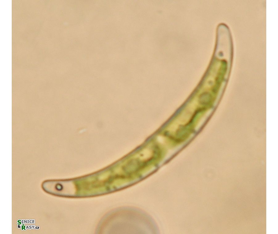 Closterium pseudopygmaeum