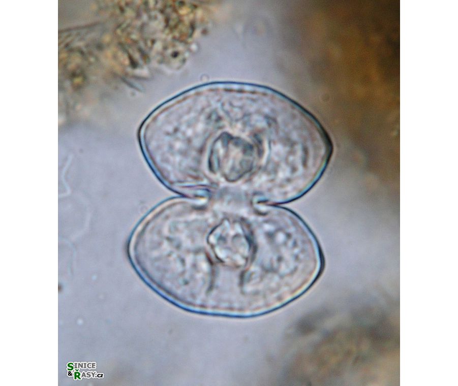Cosmarium pseudoprotuberans