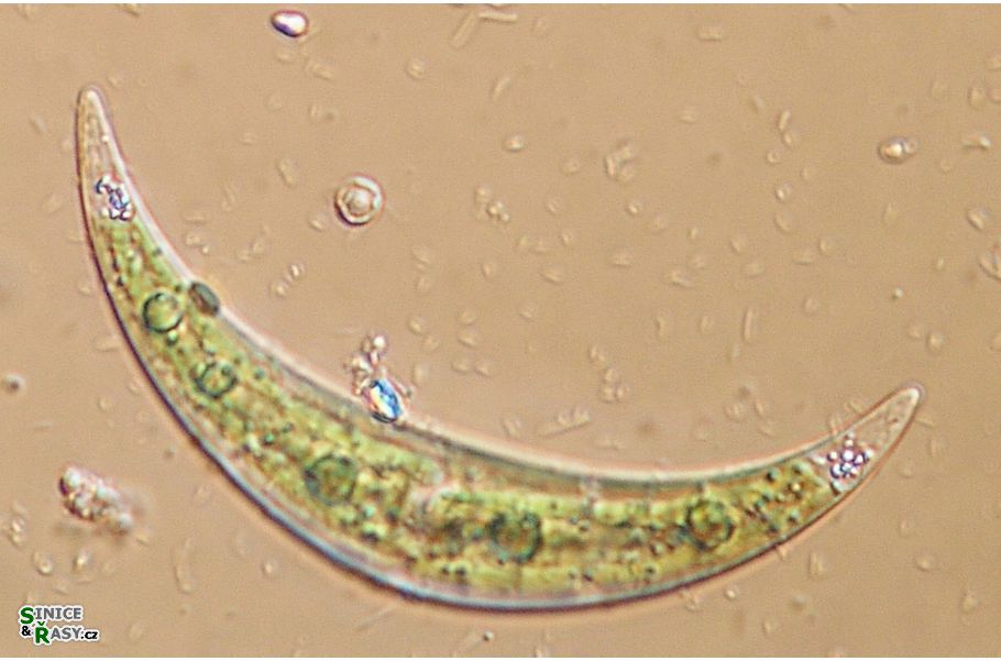 Closterium tumidulum