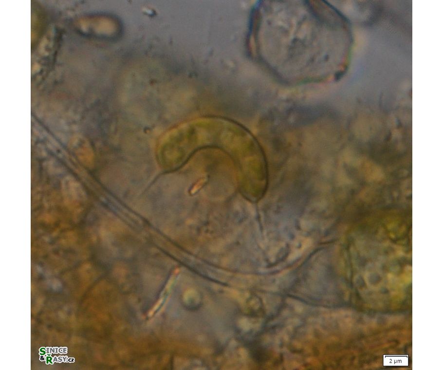 Ophiocytium capitatum