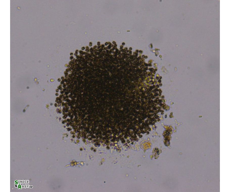 Microcystis novaceki