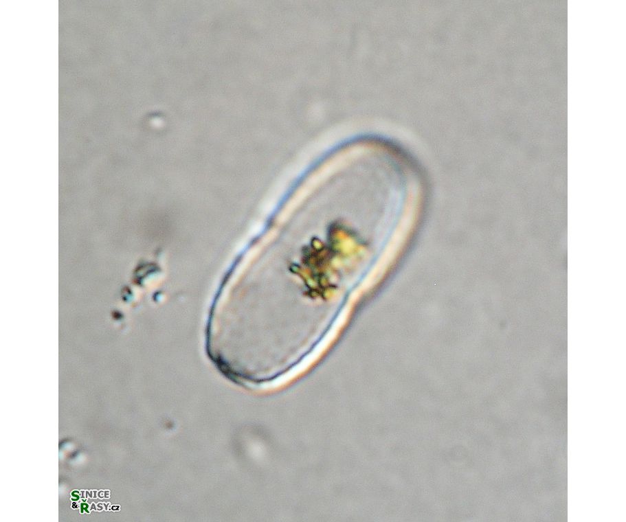 Actinotaenium kriegeri