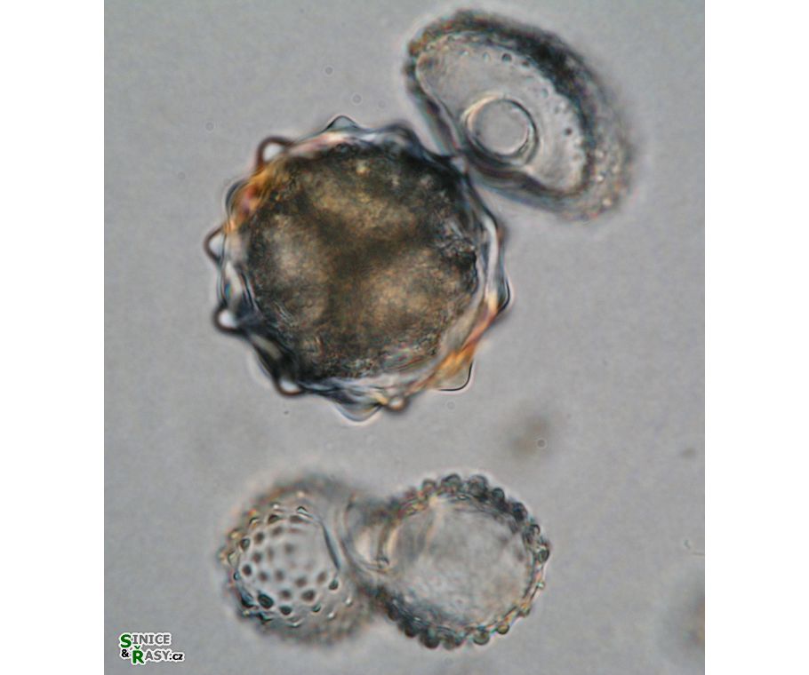 Cosmarium margaritiferum