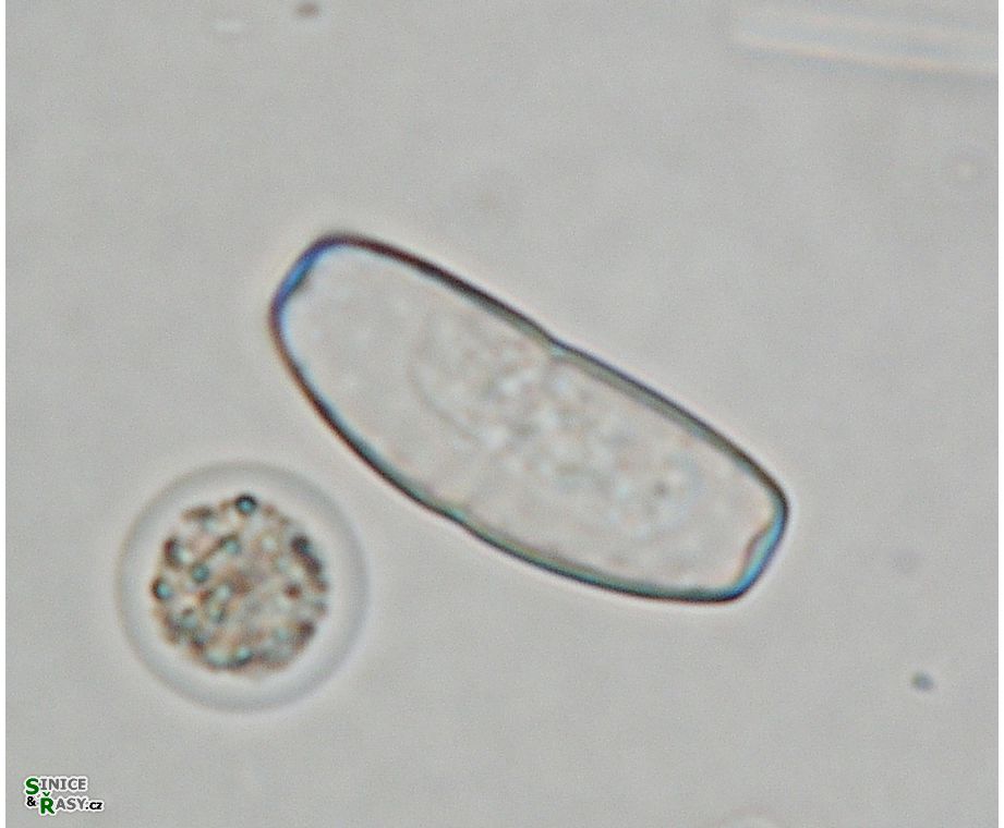 Actinotaenium infractum