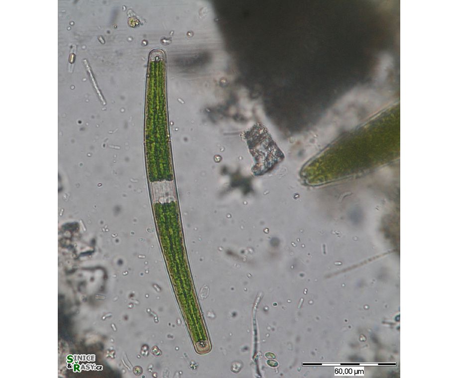 Closterium directum