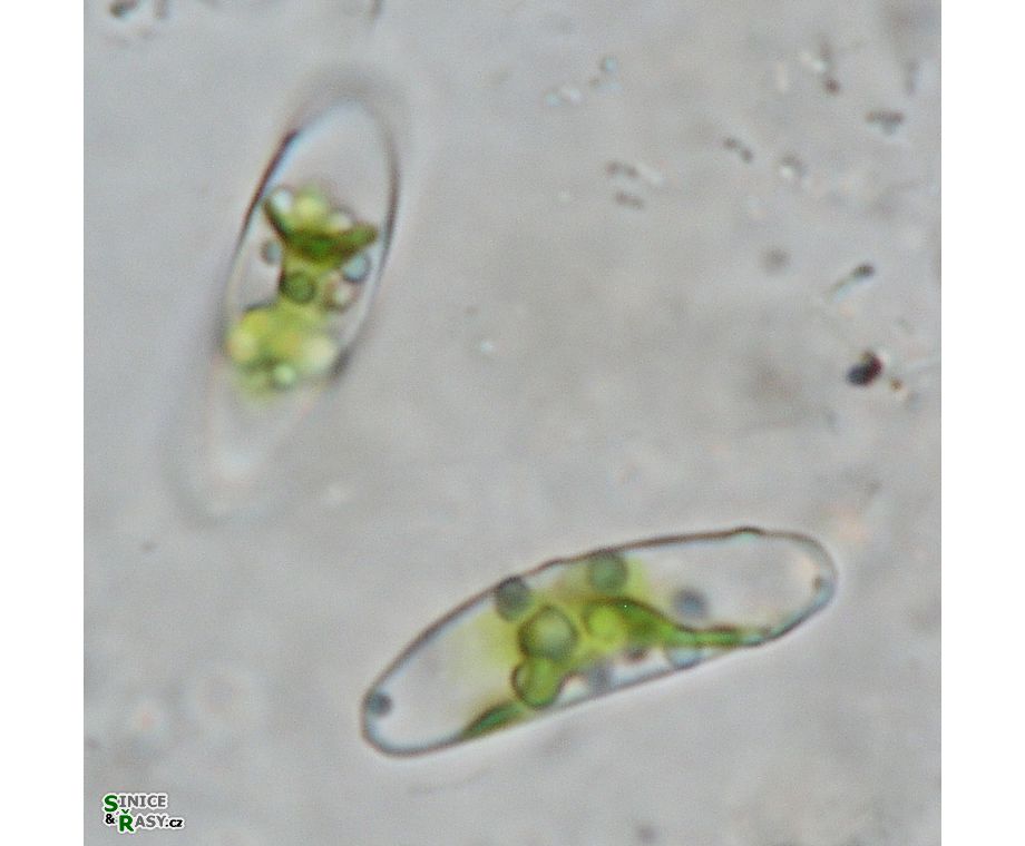Closterium