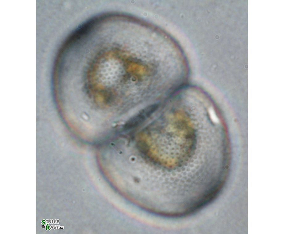 Cosmarium incrassatum