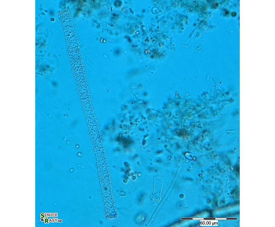 Gonatozygon aculeatum