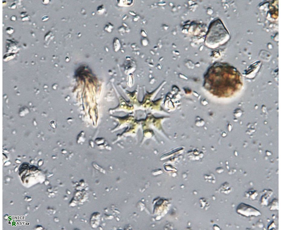 Parapediastrum biradiatum var. longicorne