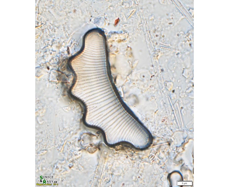 Eunotia tetraodon
