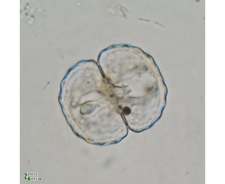 Cosmarium gibberulum