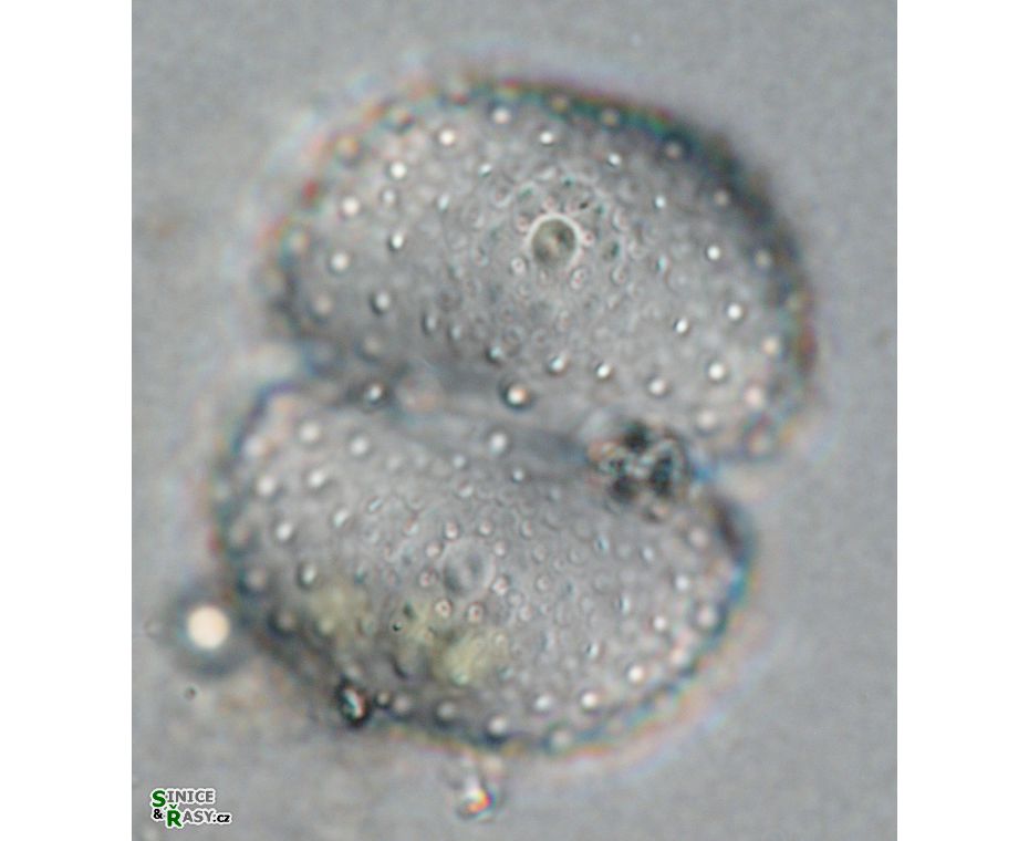 Cosmarium kirchneri