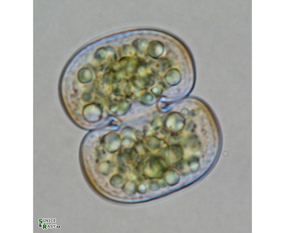 Cosmarium subtumidum