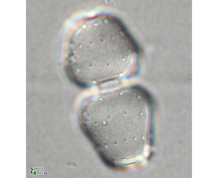 Cosmarium zonatum