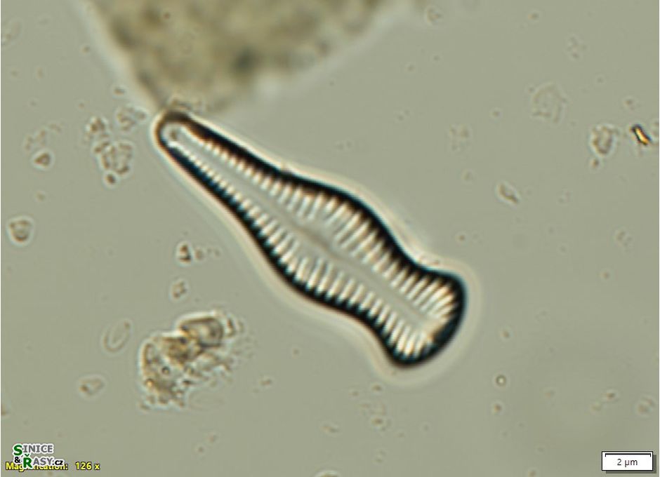 Gomphonema capitatum
