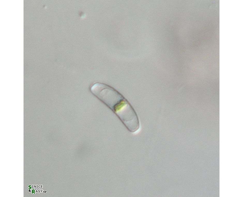 Actinotaenium inconspicuum