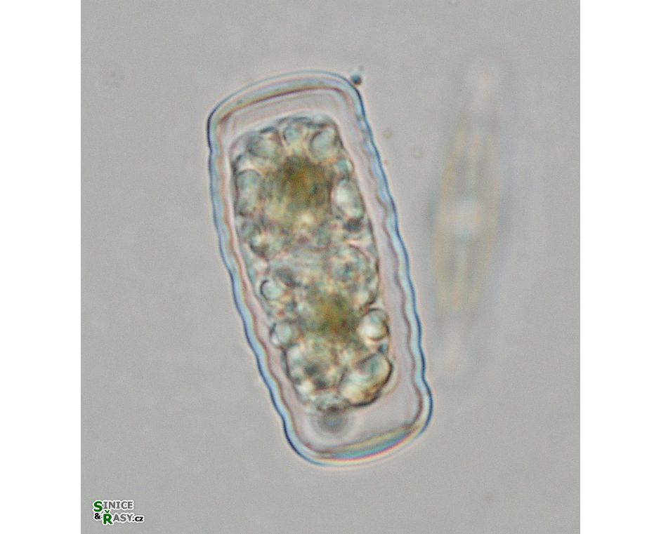 Cosmarium annulatum