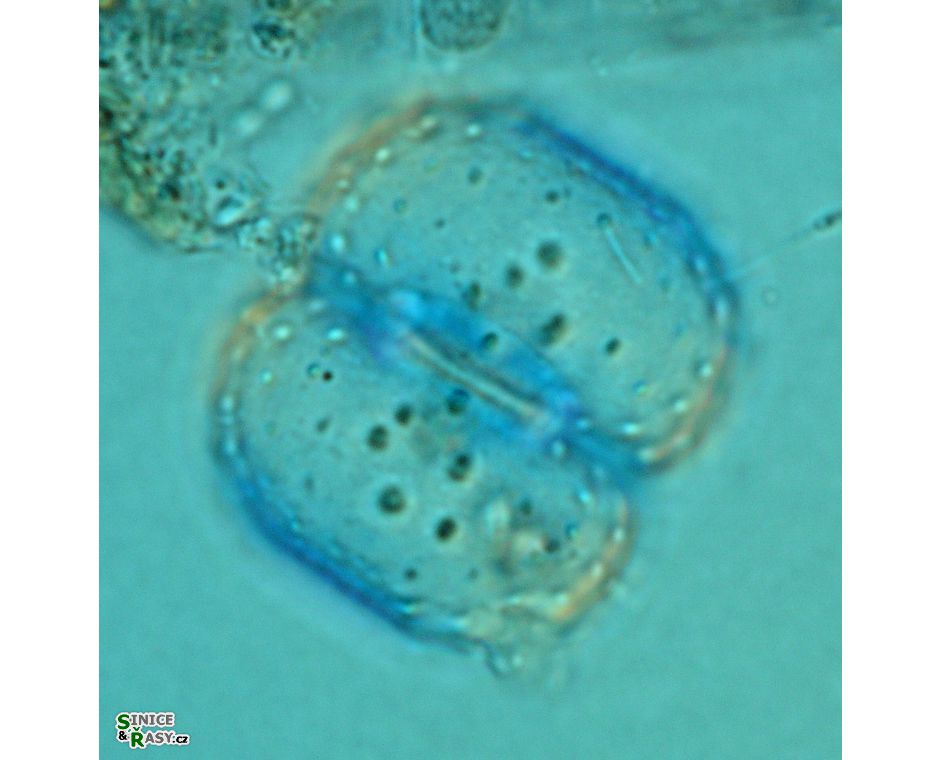 Cosmarium fastidiosum