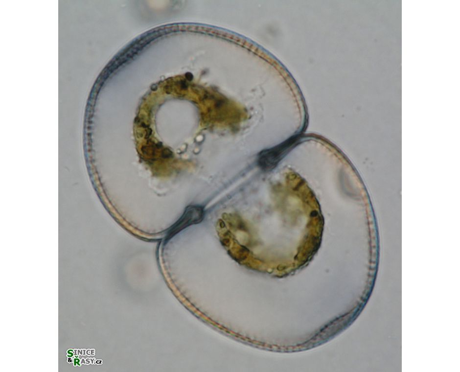 Cosmarium incrassatum