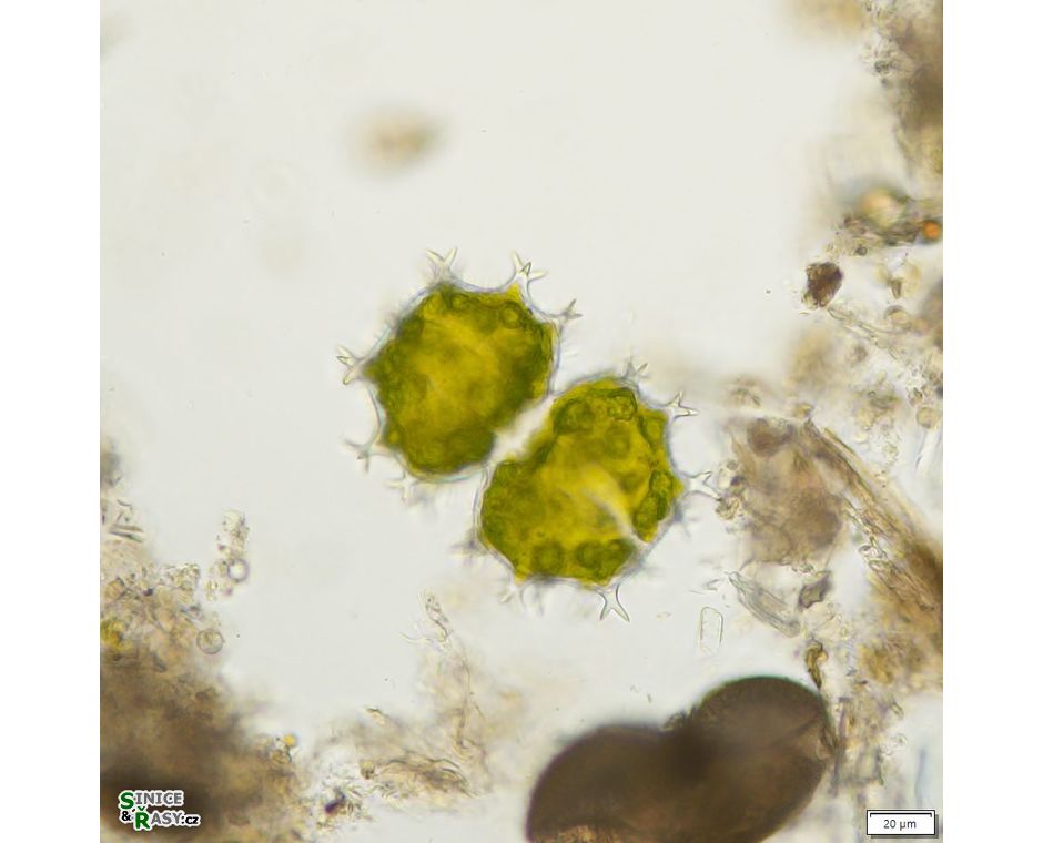Xanthidium armatum
