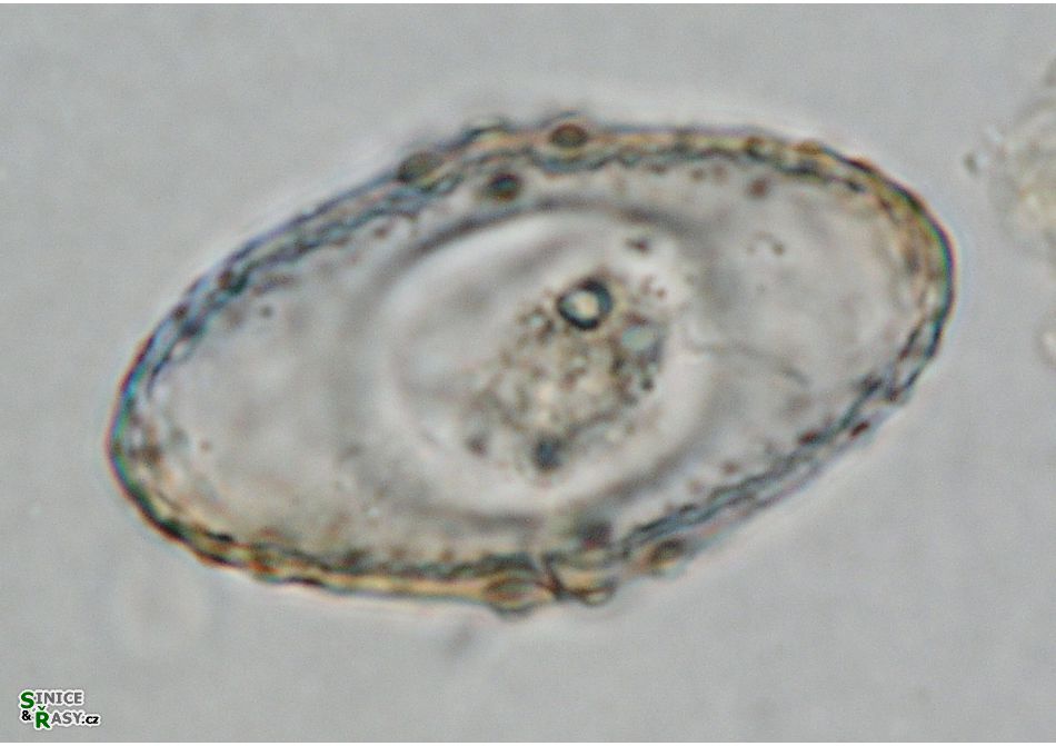 Cosmarium fastidiosum