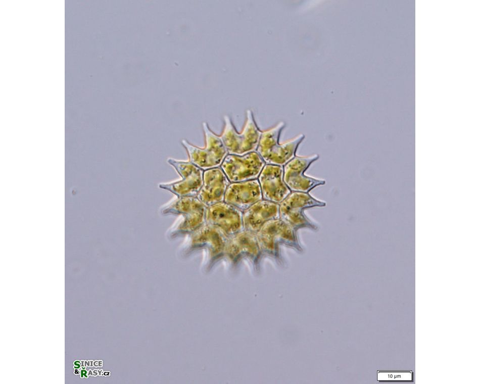 Pseudopediastrum boryanum