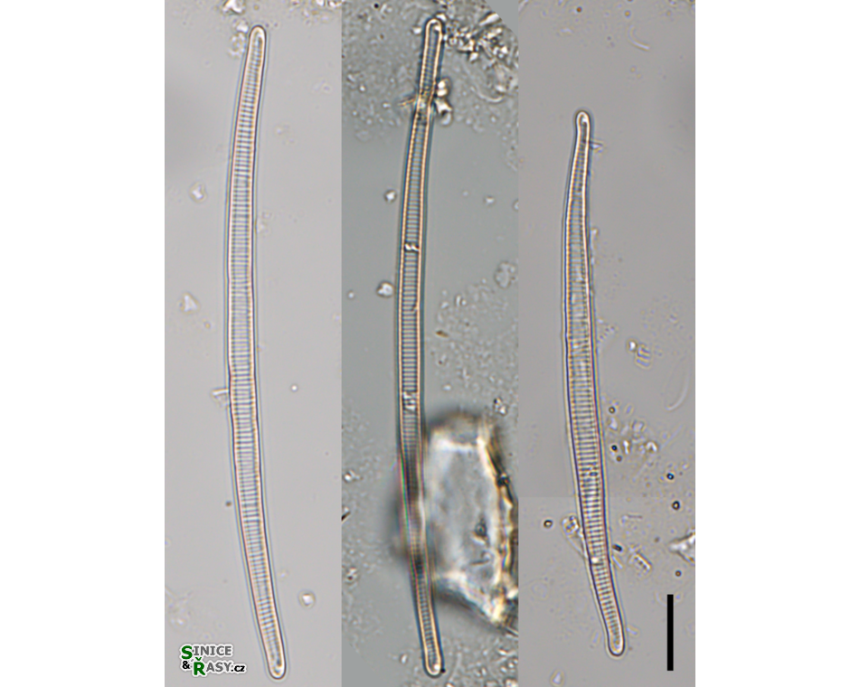 Eunotia juettnerae