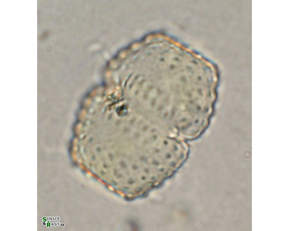 Cosmarium basiornatum