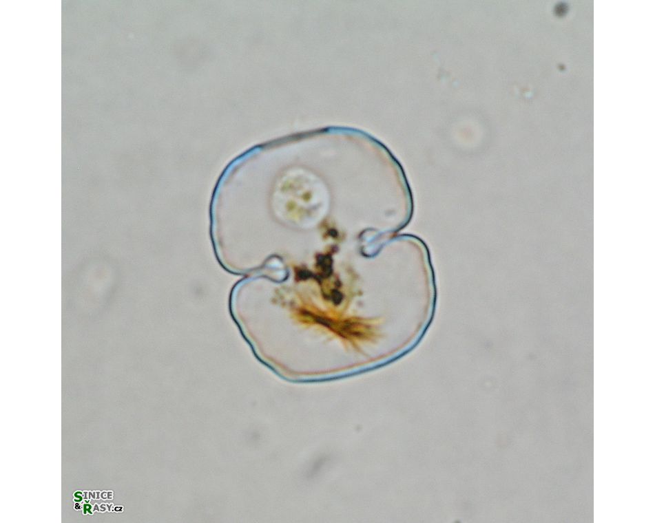 Cosmarium garrolense