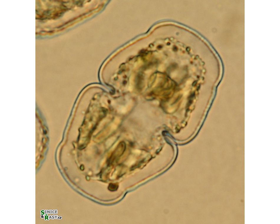 Cosmarium holmiense