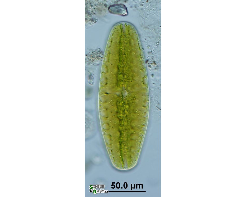 Netrium digitus