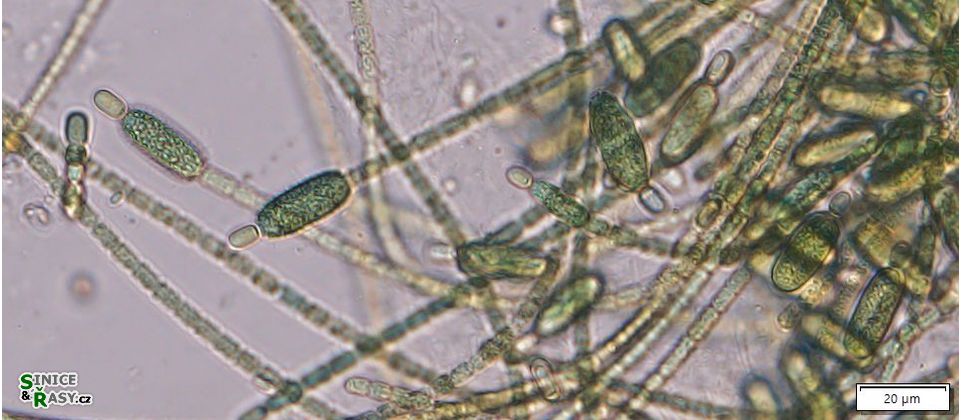 Cylindrospermum stagnale