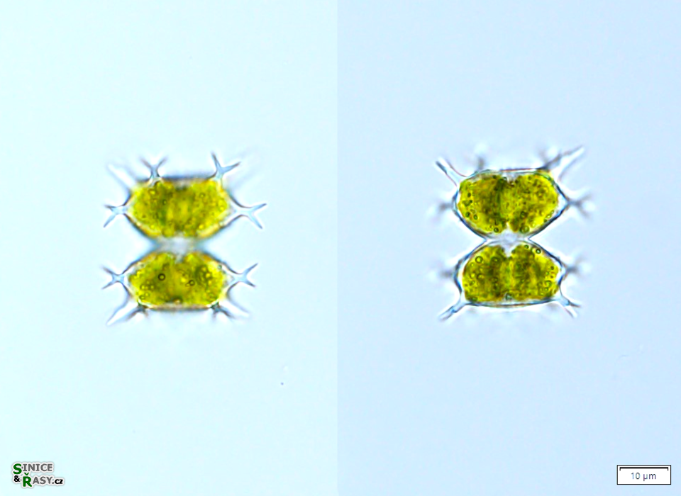 Staurastrum furcatum