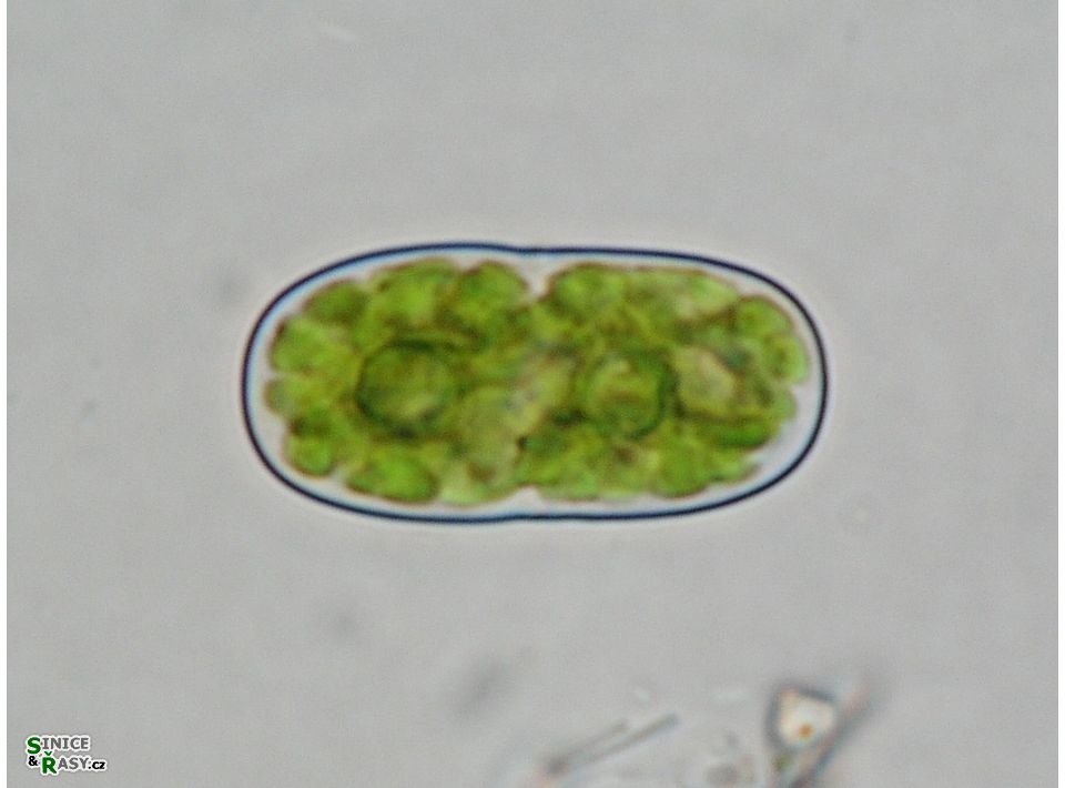 Actinotaenium