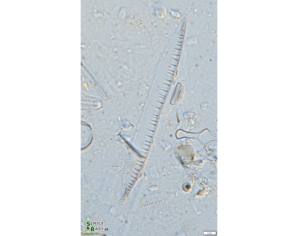 Nitzschia bremensis